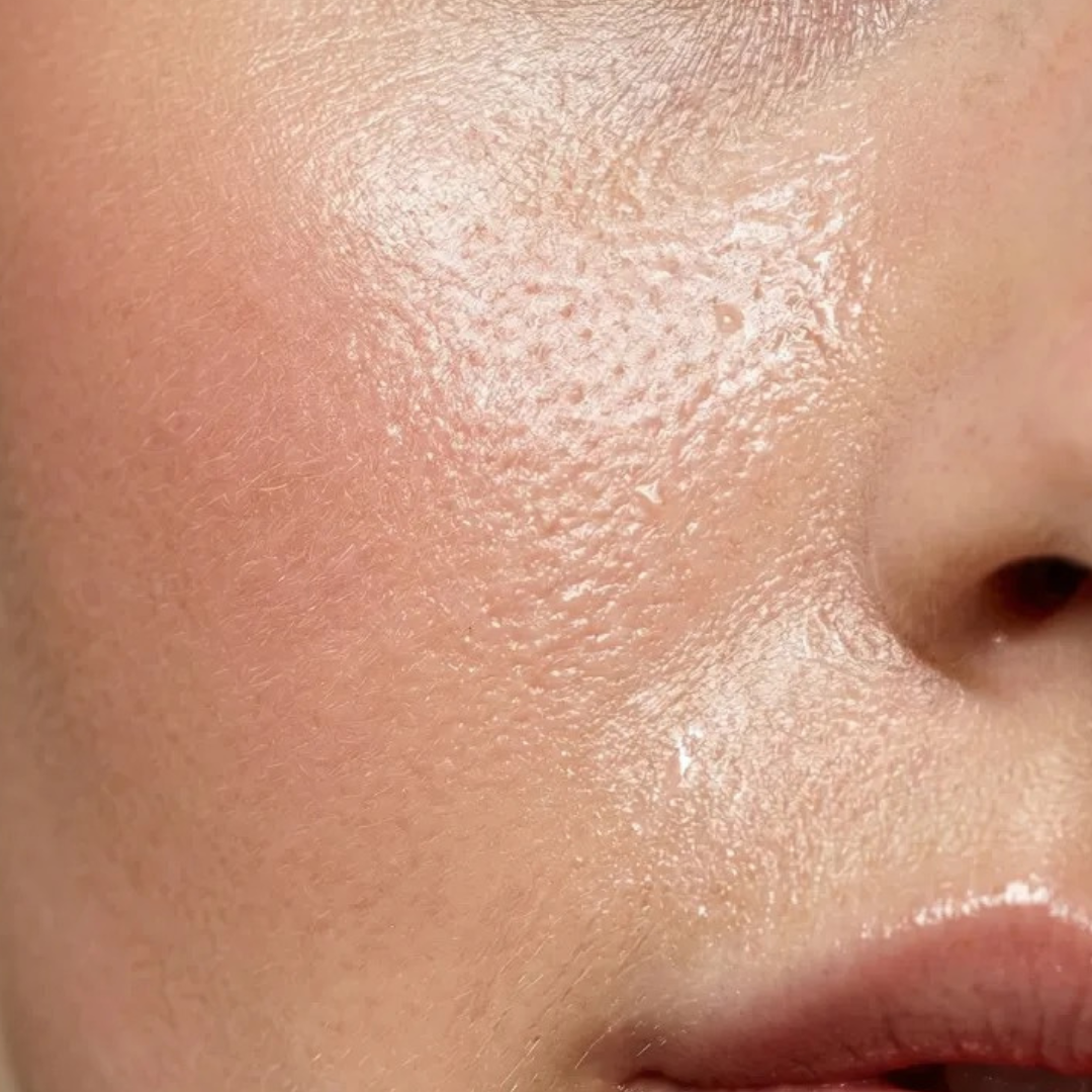 Oily Skin explained: What causes it and how to keep it balanced