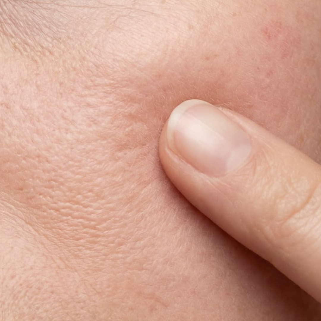 Dehydrated skin explained: causes, signs, and how to care for it