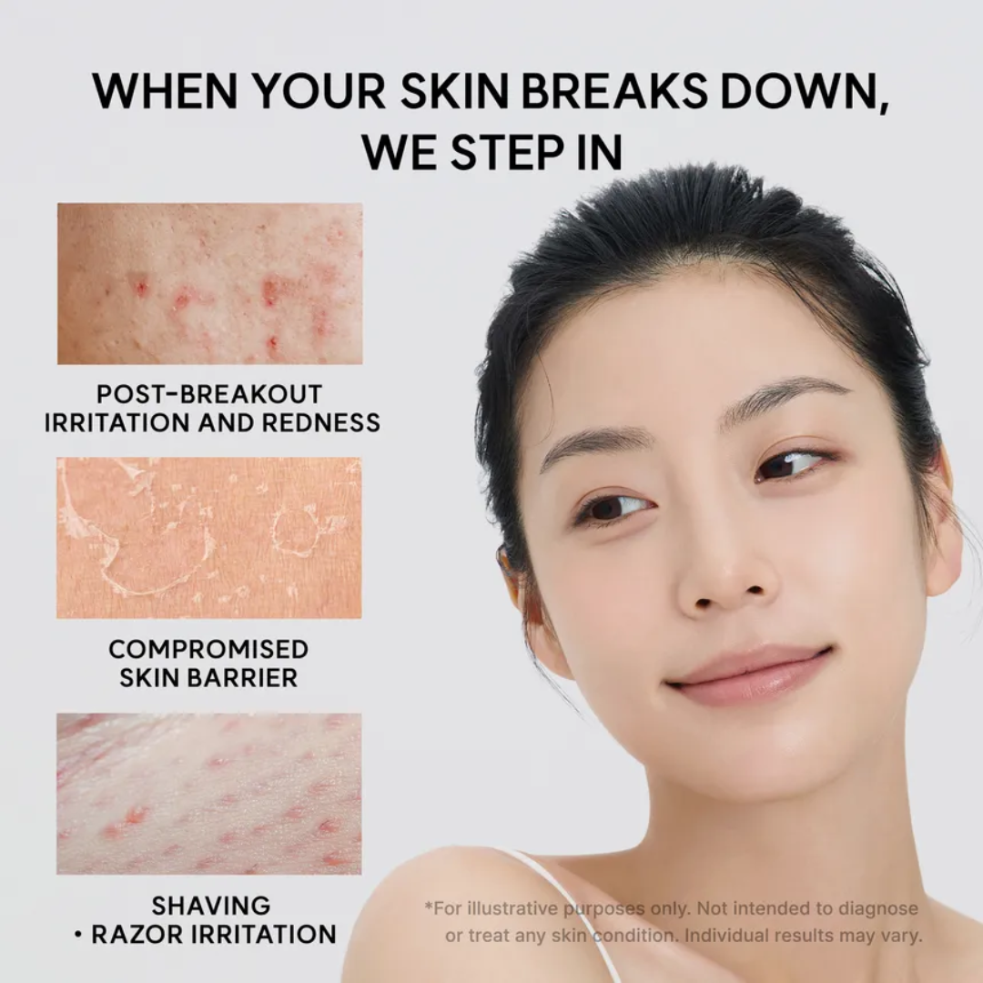Eraser Soothing Cream