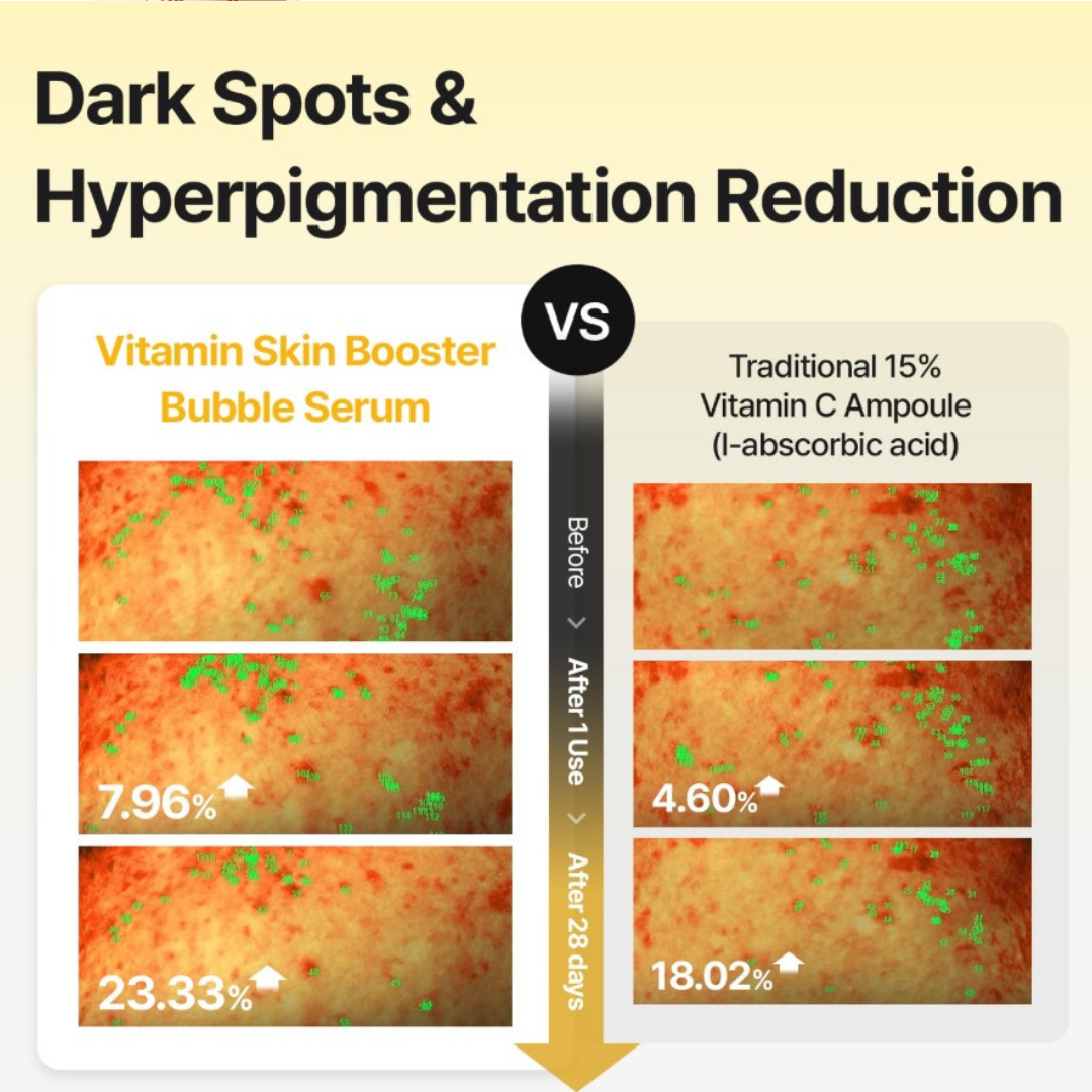 Vitamin Skin Booster Bubble Serum