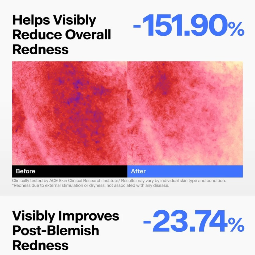 ABC Triple-Synergy Redness Comfort Serum