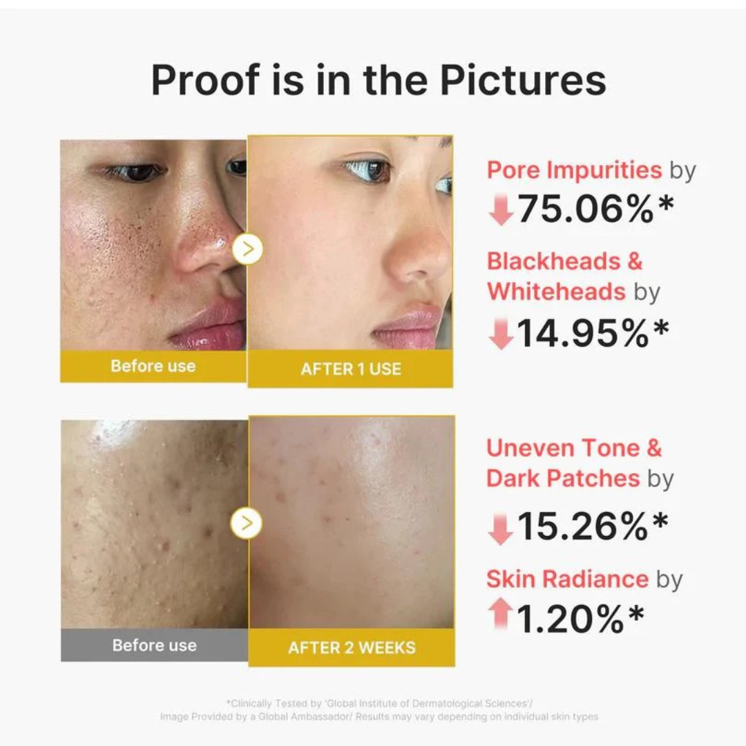 Kojic Acid Turmeric Peel Shot