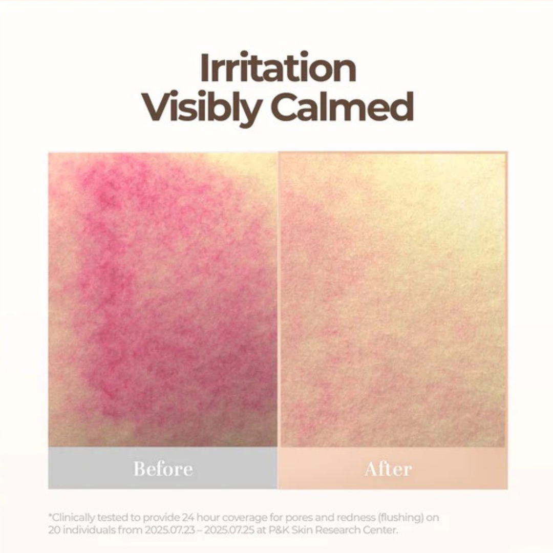 Skin Blemish Balm Intensive