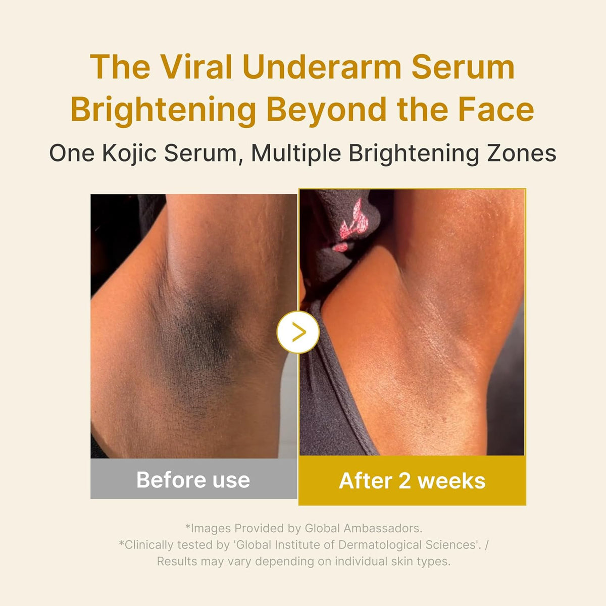 Kojic Acid Turmeric Niacinamide Serum
