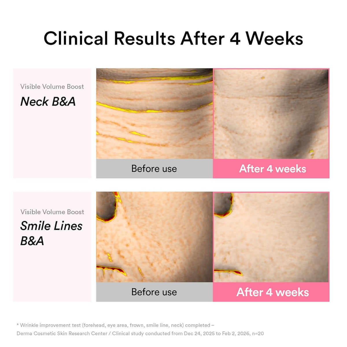PDRN Volume Fill-it Booster Crème 2.5 Tube